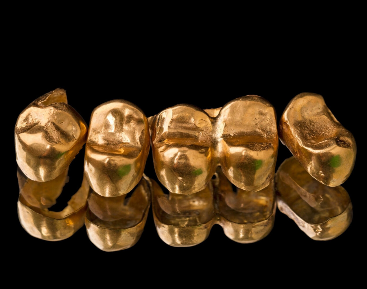 Скупка  стоматологического золота в Иркутске